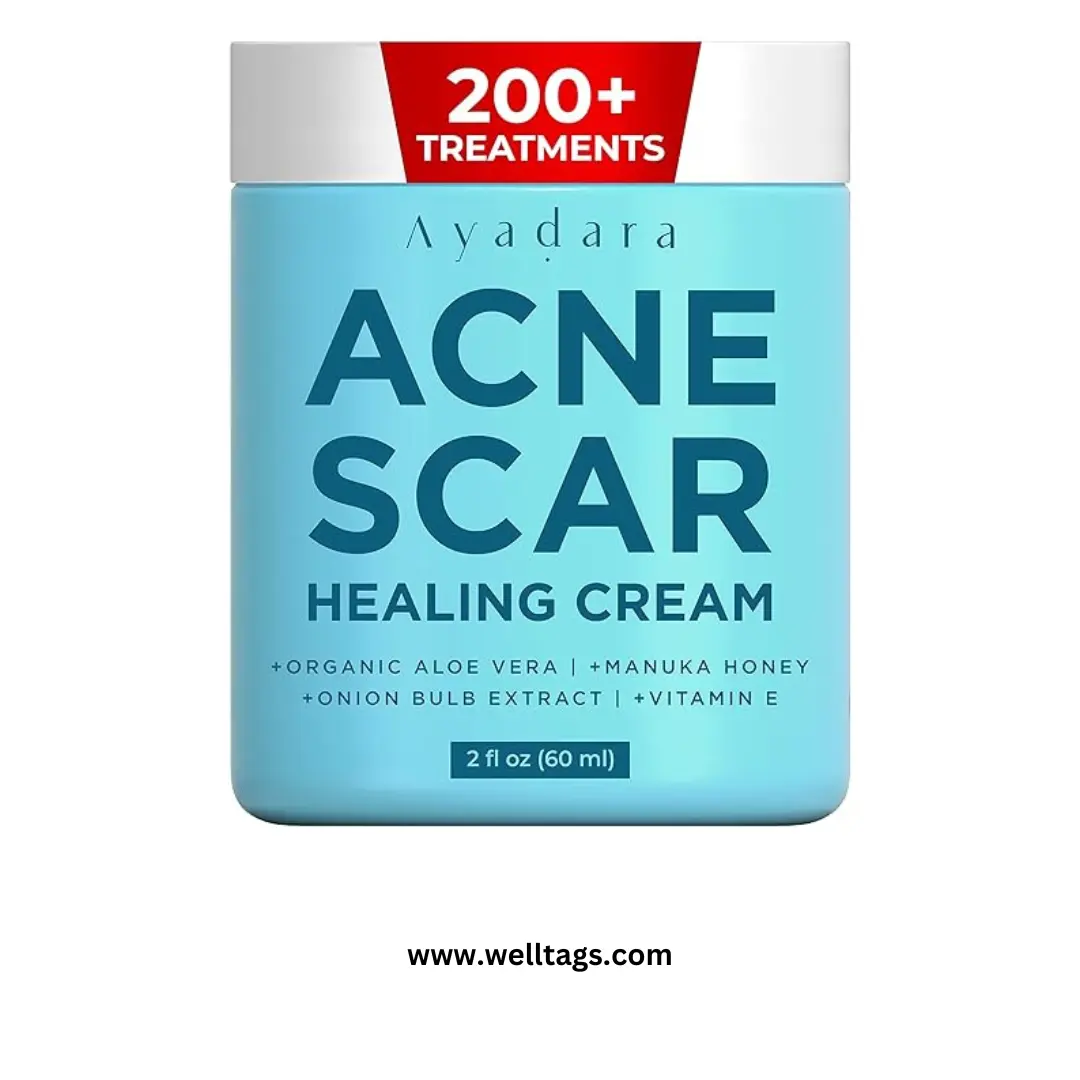 best medicated anti acne cream